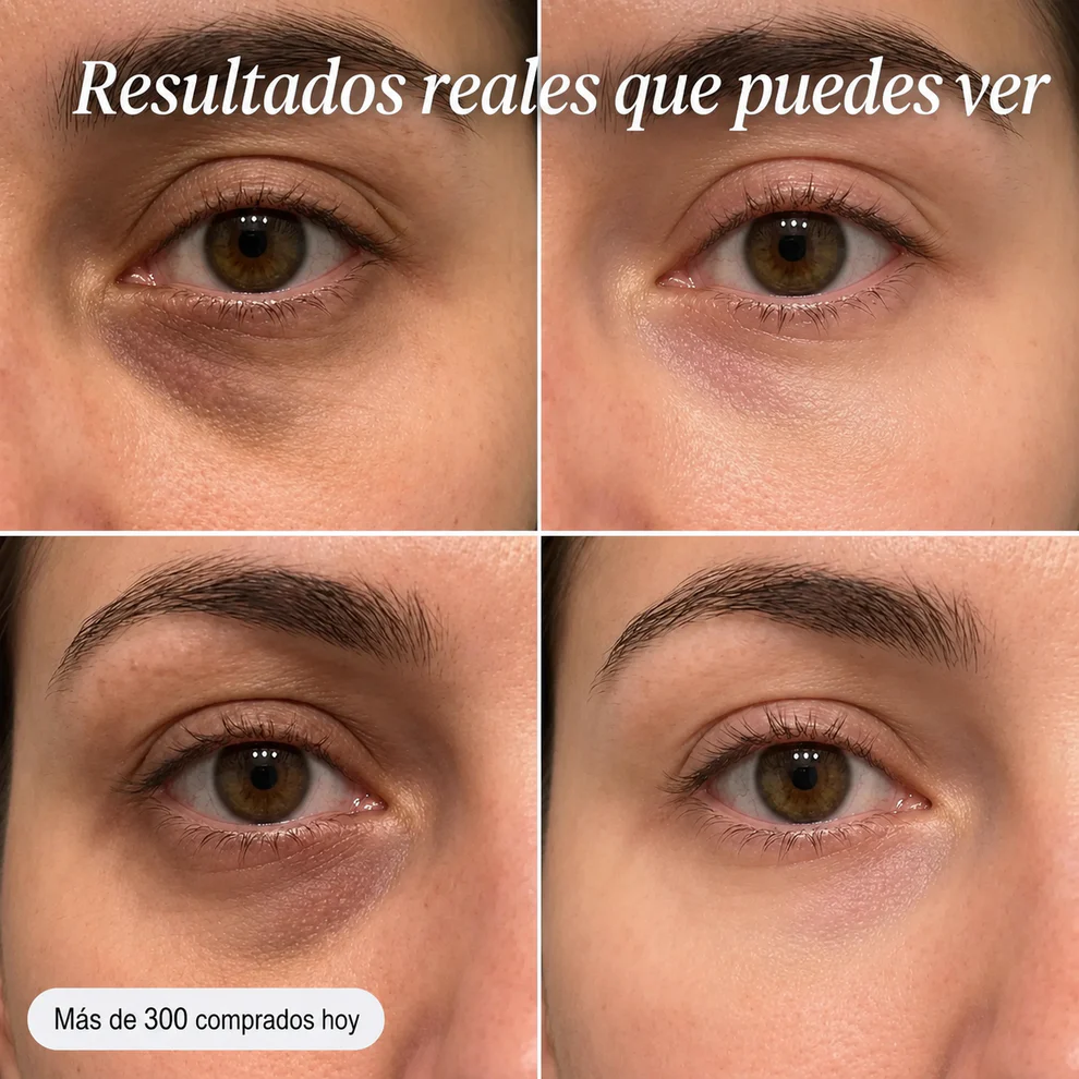 Bálsamo Volumen y Brillo Sin Agujas - MELOVE