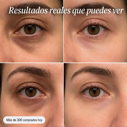 Bálsamo Volumen y Brillo Sin Agujas - MELOVE