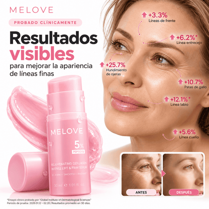 Bálsamo Volumen y Brillo Sin Agujas - MELOVE